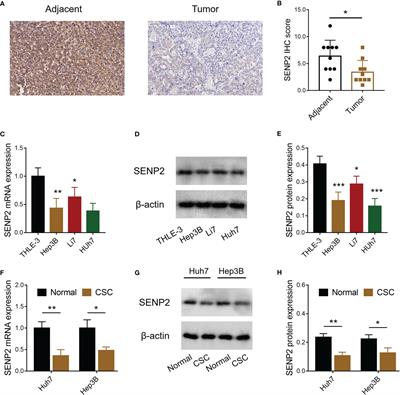 SENP2 Reduces Hepatocellular Carcinoma Stemness and Improves Sorafenib Sensitivity Through Inactivating the AKT/GSK3β/CTNNB1 Pathway